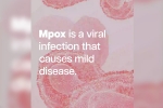 mpox cases, mpox mortality rate, mpox emergency again, Mpox